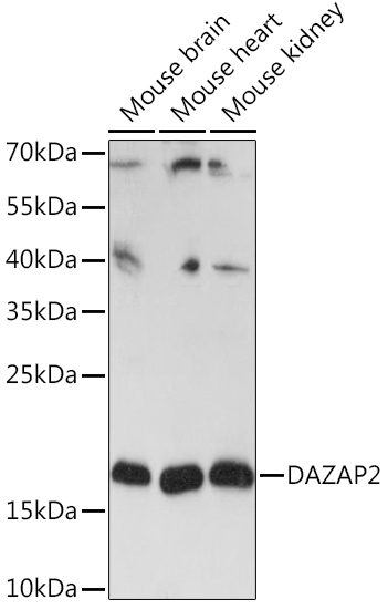 DAZAP2 Polyclonal Antibody