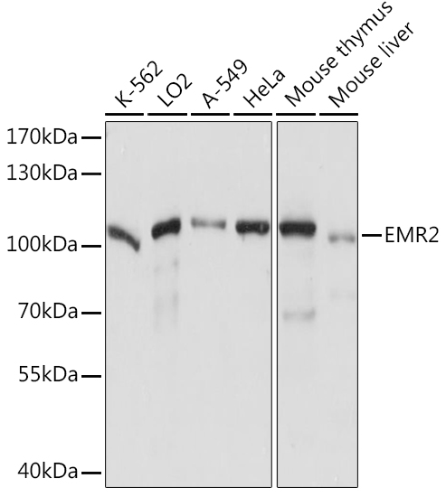 EMR2 Polyclonal Antibody