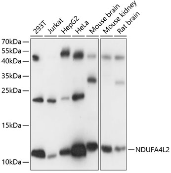 NDUFA4L2 Polyclonal Antibody