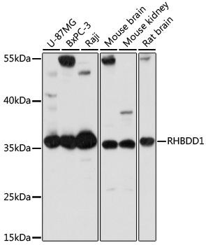 RHBDD1 Polyclonal Antibody