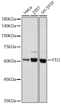 FTO Polyclonal Antibody