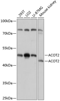 ACOT2 Polyclonal Antibody&nbsp;<img src="images/icon_newarrival.gif" alt="new" border="0">
