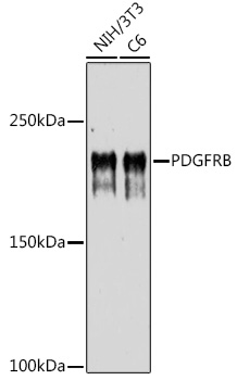 PDGFRB Polyclonal Antibody