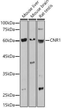 CNR1 Polyclonal Antibody