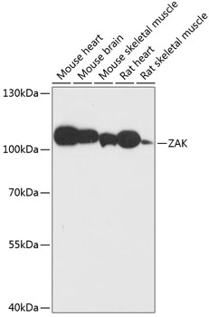 ZAK Polyclonal Antibody