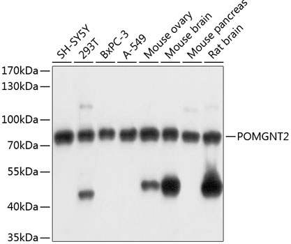 POMGNT2 Polyclonal Antibody
