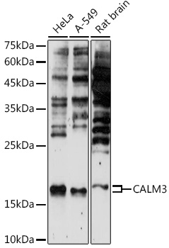 CALM3 Polyclonal Antibody