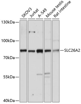 SLC26A2 Polyclonal Antibody