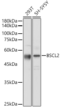 BSCL2 Polyclonal Antibody