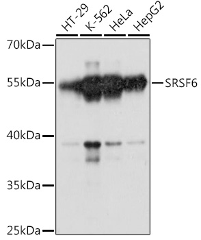 SRSF6 Polyclonal Antibody