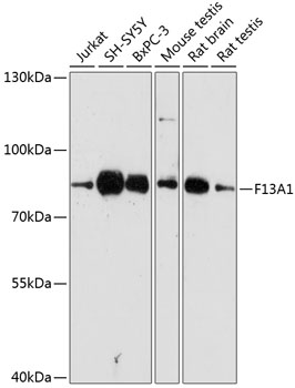 F13A1 Polyclonal Antibody