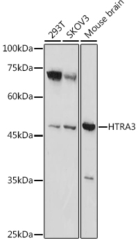 HTRA3 Polyclonal Antibody