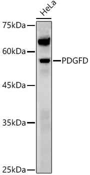 PDGFD Polyclonal Antibody