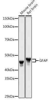 GFAP Polyclonal Antibody