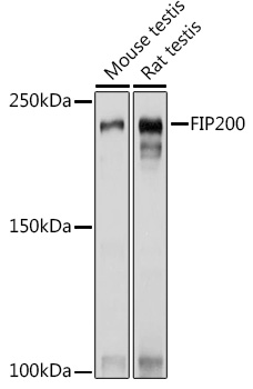 FIP200 Polyclonal Antibody