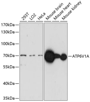 ATP6V1A Polyclonal Antibody
