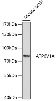 ATP6V1A Polyclonal Antibody