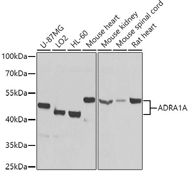 ADRA1A Polyclonal Antibody&nbsp;<img src="images/icon_newarrival.gif" alt="new" border="0">