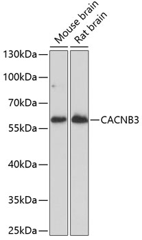 CACNB3 Polyclonal Antibody