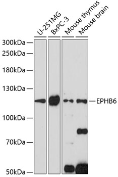 EPHB6 Polyclonal Antibody