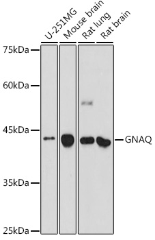 GNAQ Polyclonal Antibody