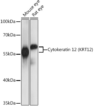Cytokeratin 12 (KRT12) Polyclonal Antibody