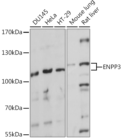 ENPP3 Polyclonal Antibody