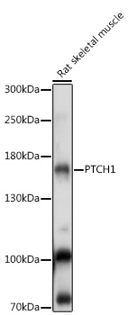 PTCH1 Polyclonal Antibody