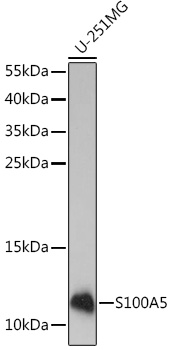 S100A5 Polyclonal Antibody