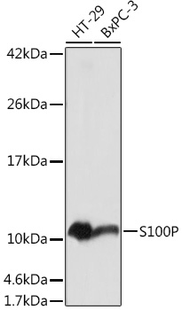 S100P Polyclonal Antibody