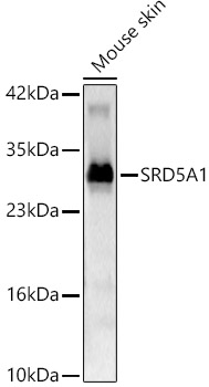 SRD5A1 Polyclonal Antibody
