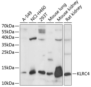 KLRC4 Polyclonal Antibody