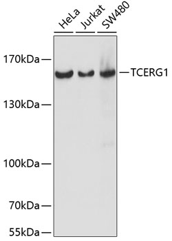 TCERG1 Polyclonal Antibody