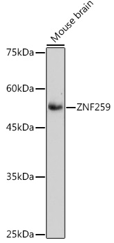 ZNF259 Monoclonal Antibody [10V1A2]