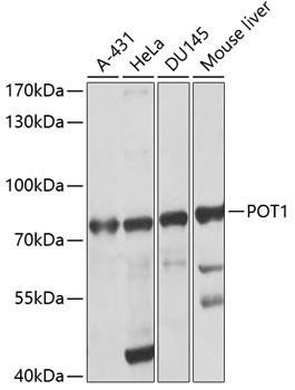POT1 Polyclonal Antibody