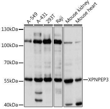 XPNPEP3 Polyclonal Antibody