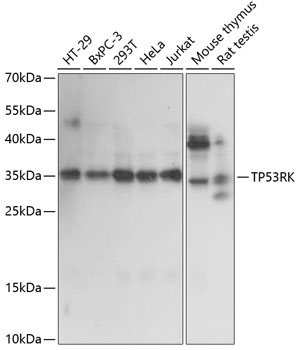 TP53RK Polyclonal Antibody
