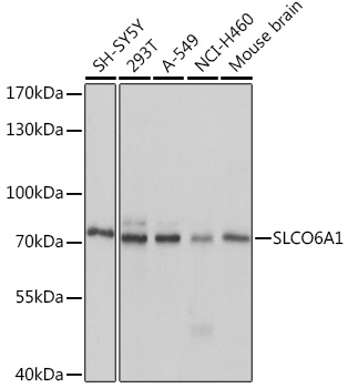 SLCO6A1 Polyclonal Antibody