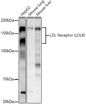 LDL Receptor (LDLR) Polyclonal Antibody