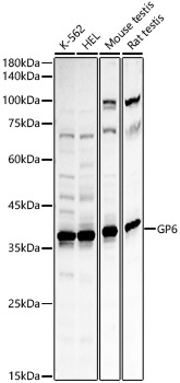 GP6 Polyclonal Antibody