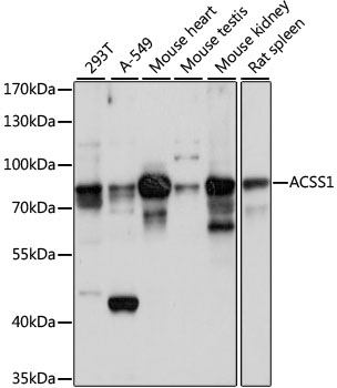 ACSS1 Polyclonal Antibody&nbsp;<img src="images/icon_newarrival.gif" alt="new" border="0">