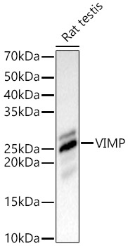 VIMP Polyclonal Antibody