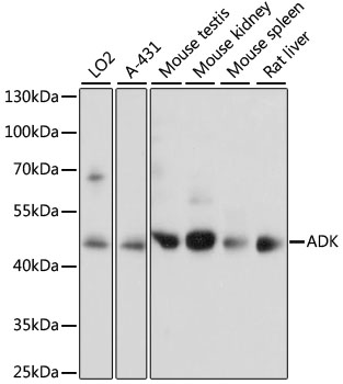 ADK Polyclonal Antibody&nbsp;<img src="images/icon_newarrival.gif" alt="new" border="0">
