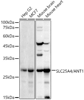SLC25A4/ANT1 Polyclonal Antibody