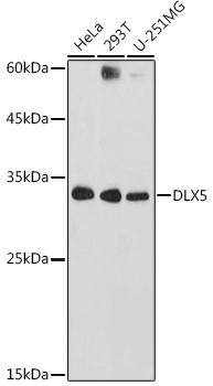 DLX5 Polyclonal Antibody