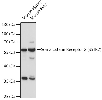 Somatostatin Receptor 2 (SSTR2) Polyclonal Antibody