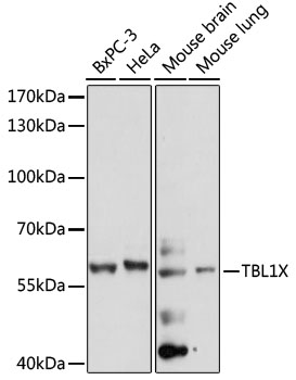 TBL1X Polyclonal Antibody