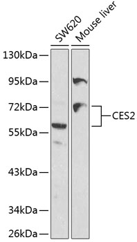 CES2 Polyclonal Antibody