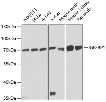 IGF2BP1/IMP1 Polyclonal Antibody