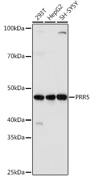 PRR5 Polyclonal Antibody